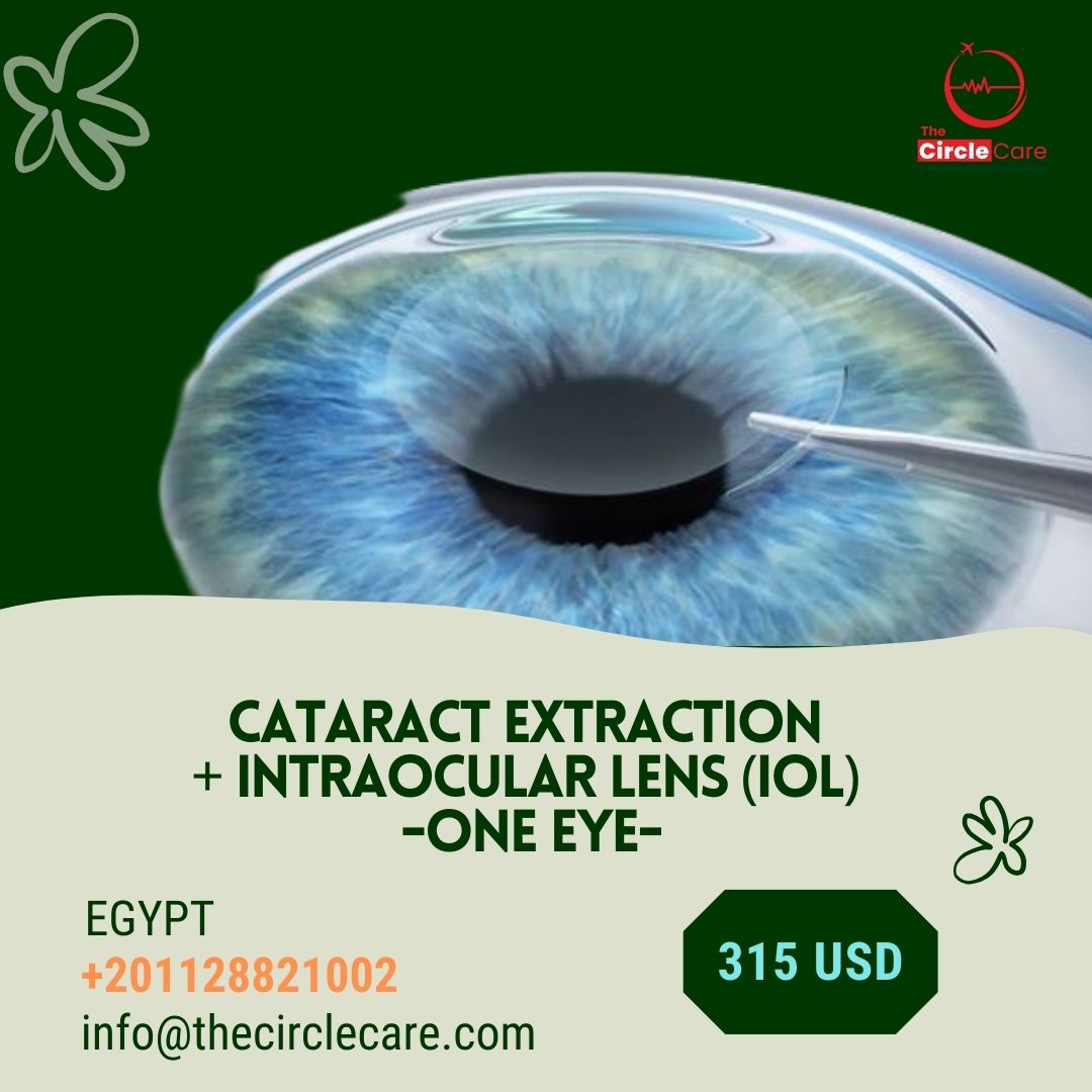Cataract Treatment: Restore Your Vision with TheCircleCare-at $235 usd only