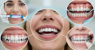 Dental Treatment in Egypt | Veneers, Crowns & Dental Implants