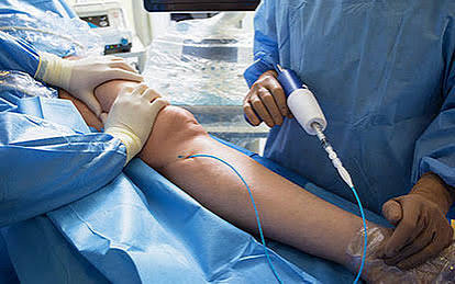Affordable Vein Treatment in Egypt