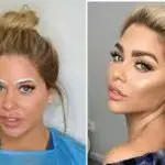 Before and after comparison photos of a woman showing dense and natural-looking results following a cosmetic eyebrow transplant procedure