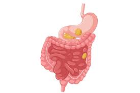 Neuroendocrine Tumor