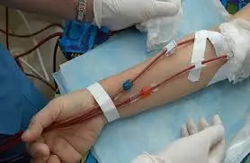 علاج الأوعية الدموية