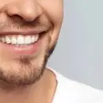 لقطة مقربة لابتسامة رجل تظهر أسنانه البيضاء المستقيمة والمنظمة بعد خضوعه لجراحة تجميل الأسنان أو تركيب قشور ابتسامة هوليود (الفينير)