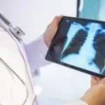 طبيب يمسك جهازًا لوحيًا يعرض صورة أشعة سينية (X-ray) للصدر لمراجعة الفحوصات الطبية والرئتين للتشخيص